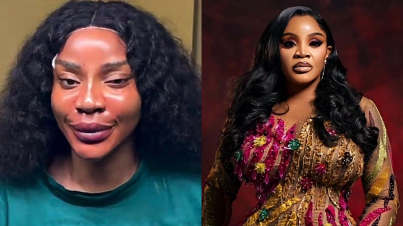Uche Ogbodo announces threads fillers PDO treatments