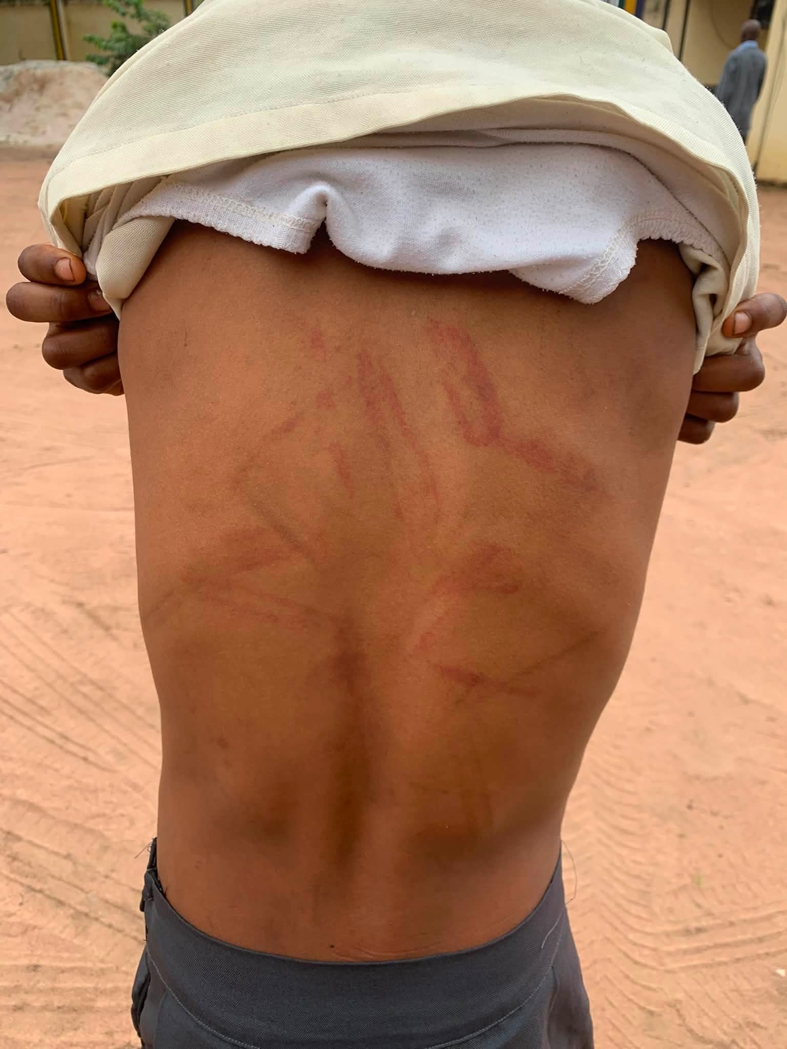 brutalized 10yr old